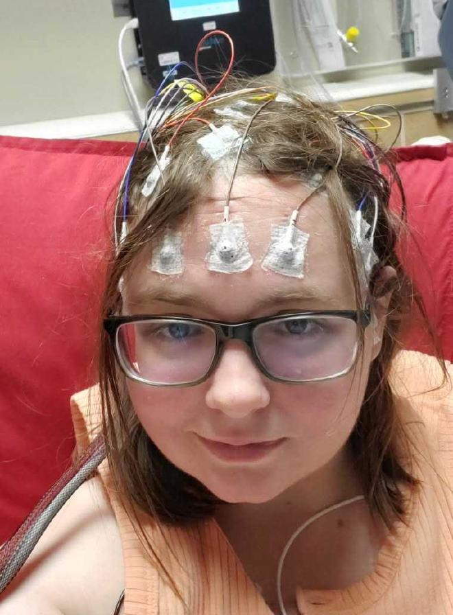 Photo of me in a hospital bed with EEG sensors stuck all over my head, wires connecting to a monitoring machine